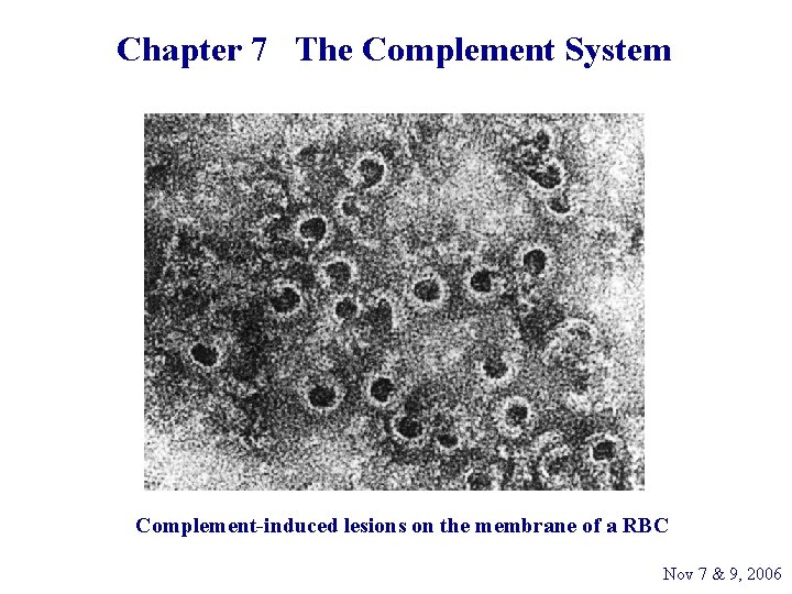 Chapter 7 The Complement System Complementinduced lesions on