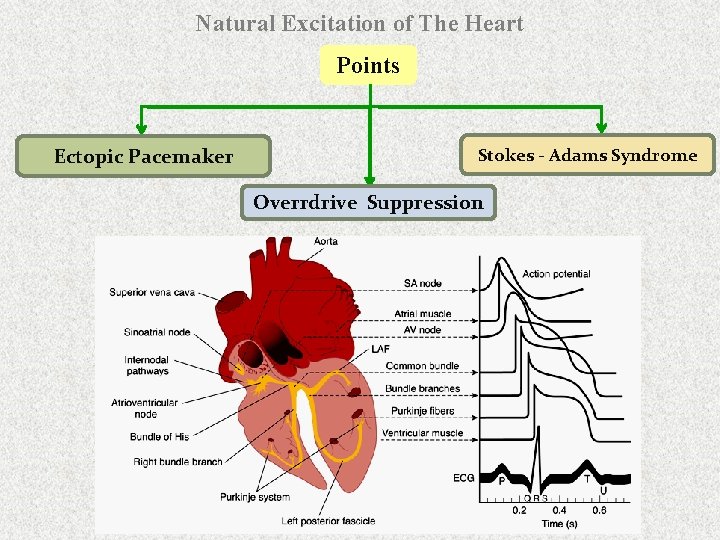 Natural Excitation of The Heart Points Ectopic Pacemaker Stokes - Adams Syndrome Overrdrive Suppression