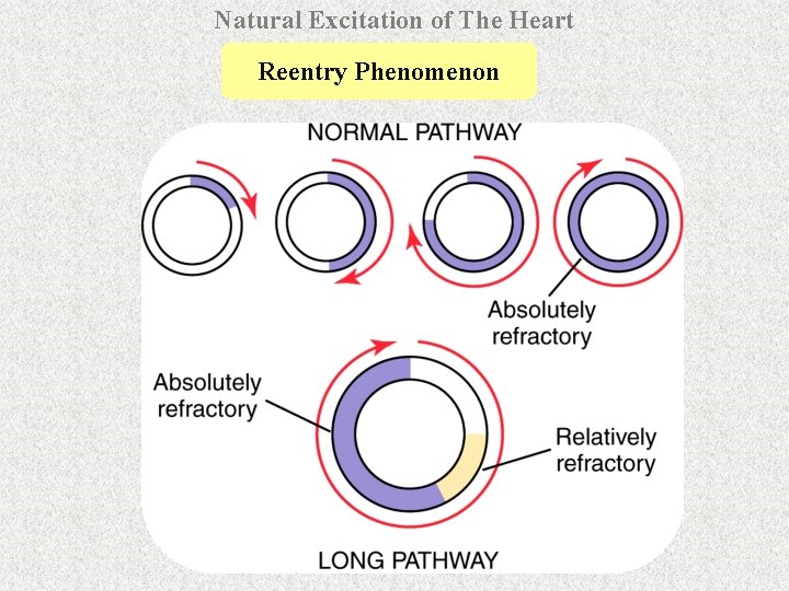 Natural Excitation of The Heart Reentry Phenomenon 