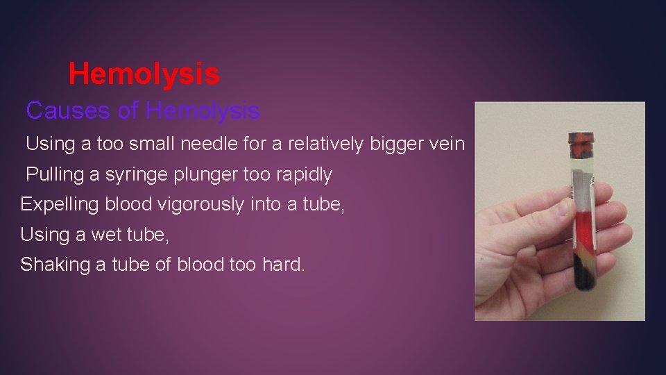 Hemolysis Causes of Hemolysis Using a too small needle for a relatively bigger vein Hemolysis Causes of Hemolysis Using a too small needle for a relatively bigger vein