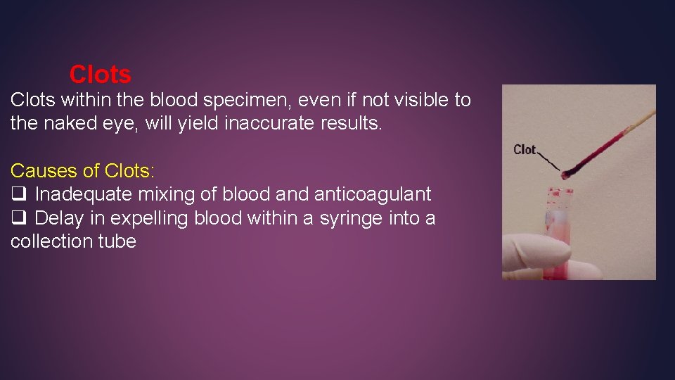 Clots within the blood specimen, even if not visible to the naked eye, will Clots within the blood specimen, even if not visible to the naked eye, will
