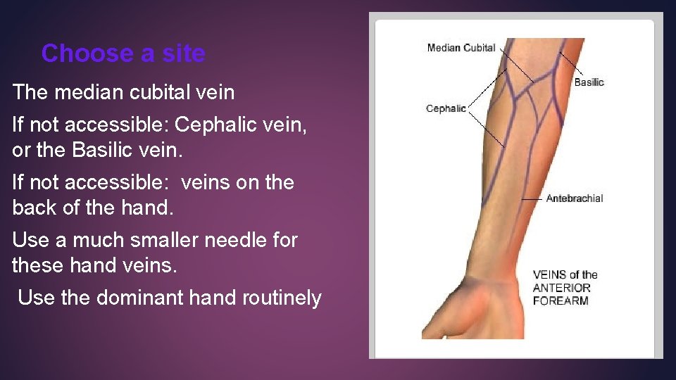 Choose a site The median cubital vein If not accessible: Cephalic vein, or the Choose a site The median cubital vein If not accessible: Cephalic vein, or the