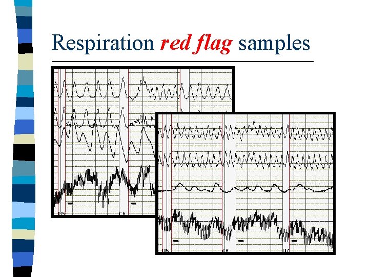 Respiration red flag samples 