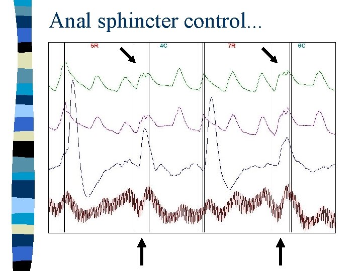 Anal sphincter control. . . 