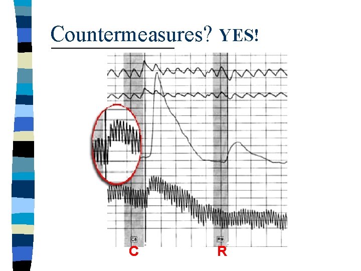 Countermeasures? YES! C R 