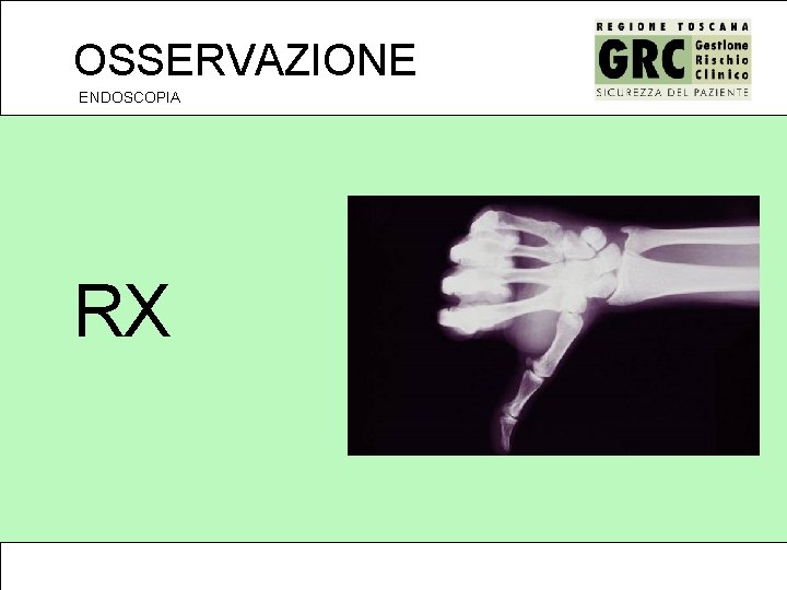 OSSERVAZIONE ENDOSCOPIA RX 