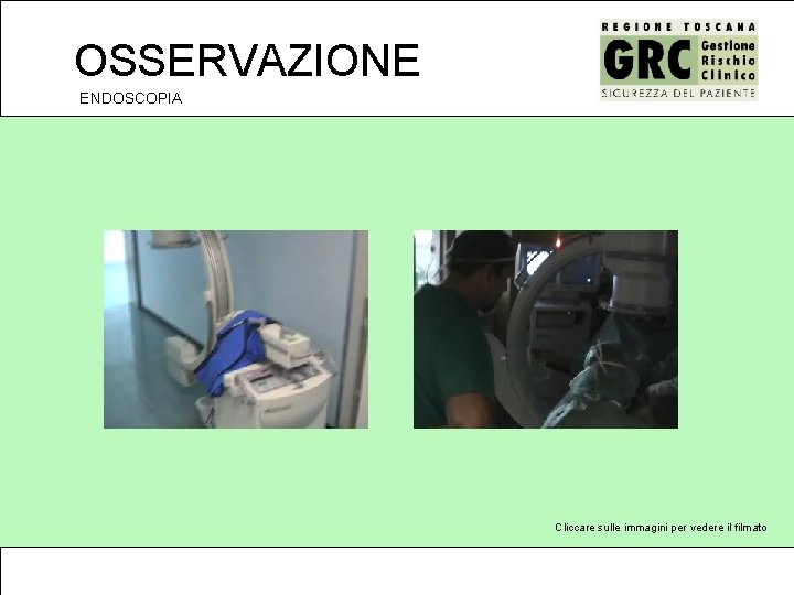OSSERVAZIONE ENDOSCOPIA Cliccare sulle immagini per vedere il filmato 