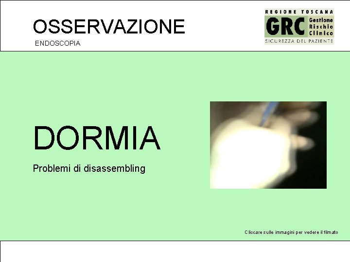 OSSERVAZIONE ENDOSCOPIA DORMIA Problemi di disassembling Cliccare sulle immagini per vedere il filmato 