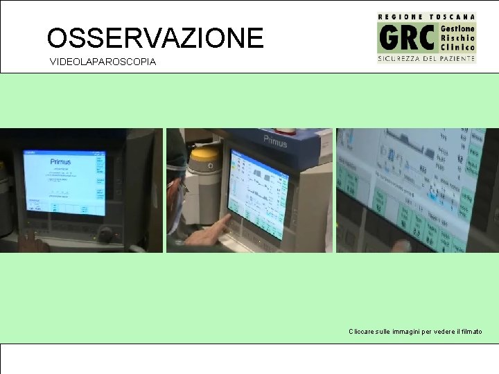 OSSERVAZIONE VIDEOLAPAROSCOPIA Cliccare sulle immagini per vedere il filmato 