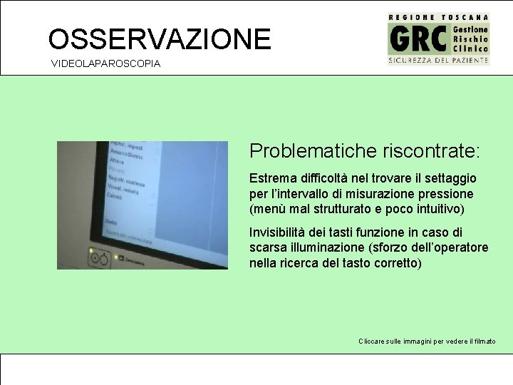 OSSERVAZIONE VIDEOLAPAROSCOPIA Problematiche riscontrate: Estrema difficoltà nel trovare il settaggio per l’intervallo di misurazione