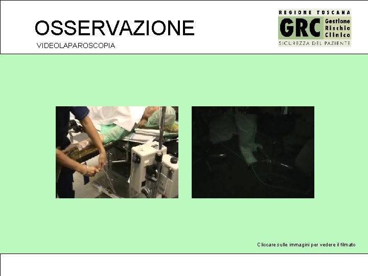 OSSERVAZIONE VIDEOLAPAROSCOPIA Cliccare sulle immagini per vedere il filmato 