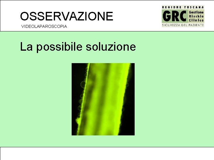 OSSERVAZIONE VIDEOLAPAROSCOPIA La possibile soluzione 
