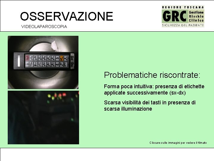 OSSERVAZIONE VIDEOLAPAROSCOPIA Problematiche riscontrate: Forma poca intuitiva: presenza di etichette applicate successivamente (sx-dx) Scarsa