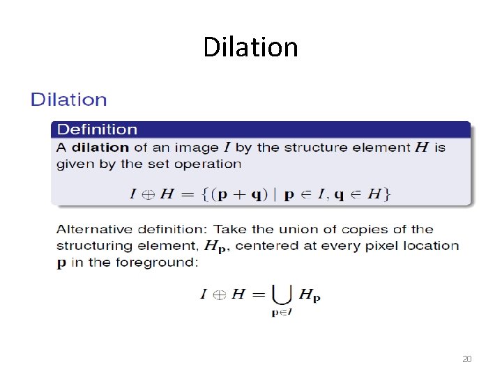 Dilation 20 