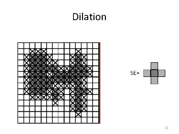 Dilation 22 