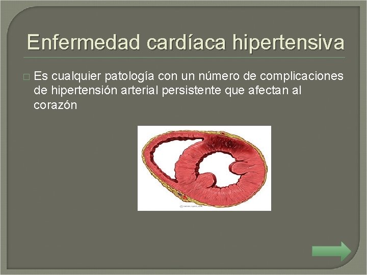 Enfermedad cardíaca hipertensiva � Es cualquier patología con un número de complicaciones de hipertensión