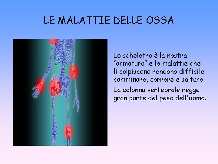 LE MALATTIE DELLE OSSA Lo scheletro è la nostra “armatura” e le malattie che