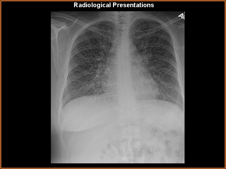 Radiological Presentations 