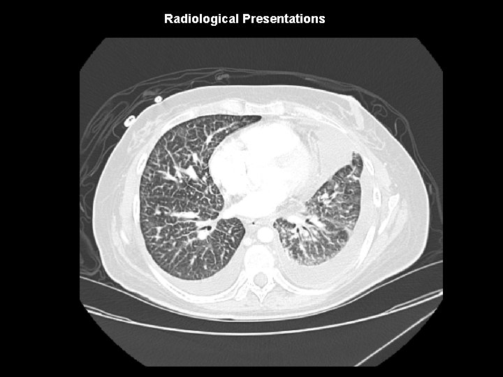 Radiological Presentations 