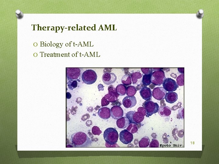 Therapy-related AML O Biology of t-AML O Treatment of t-AML 18 