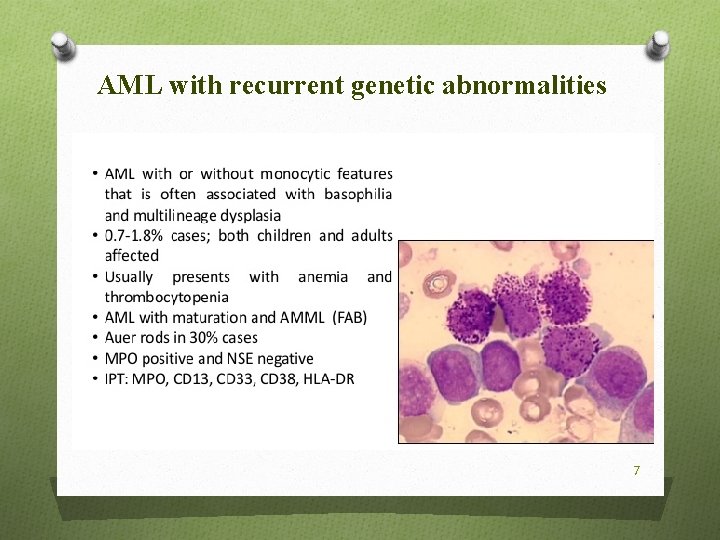 AML with recurrent genetic abnormalities 7 