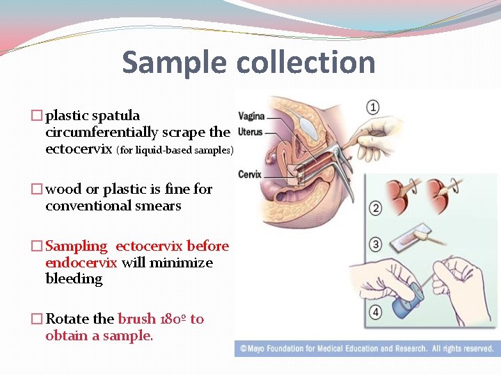 Sample collection �plastic spatula circumferentially scrape the ectocervix (for liquid-based samples) �wood or plastic