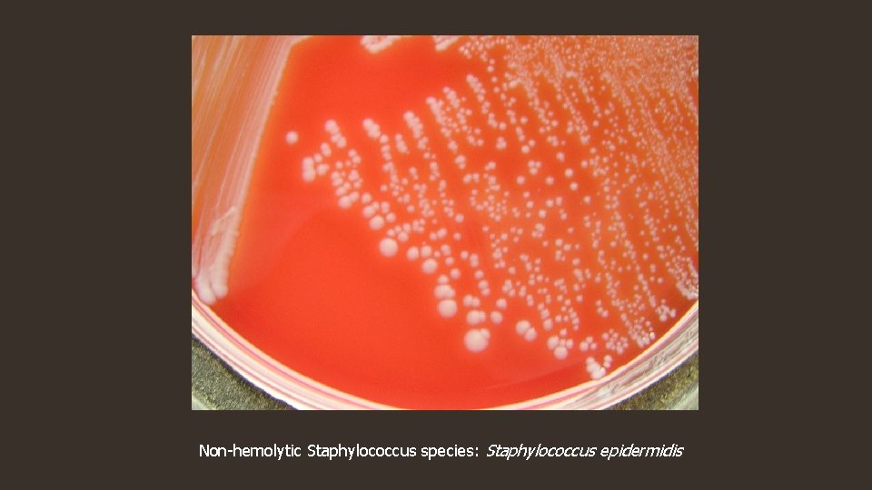 Non-hemolytic Staphylococcus species: Staphylococcus epidermidis 