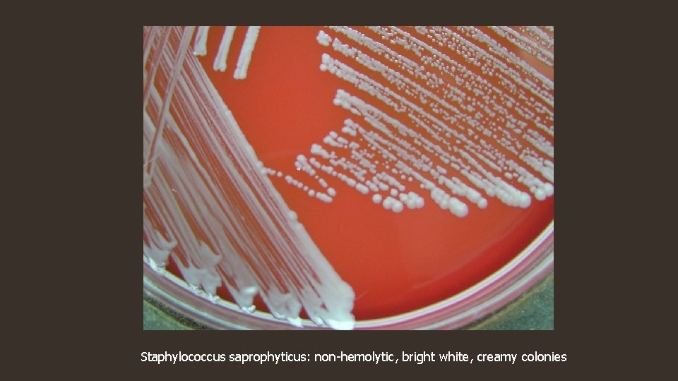 Staphylococcus saprophyticus: non-hemolytic, bright white, creamy colonies 