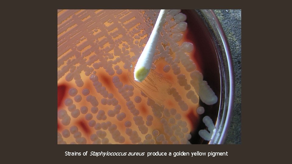 Strains of Staphylococcus aureus produce a golden yellow pigment 