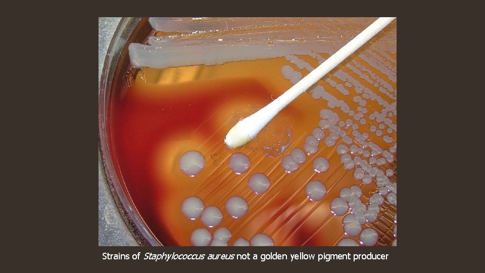 Strains of Staphylococcus aureus not a golden yellow pigment producer 