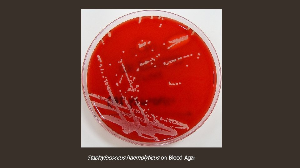 Staphylococcus haemolyticus on Blood Agar 