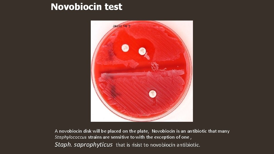 Novobiocin test A novobiocin disk will be placed on the plate, Novobiocin is an