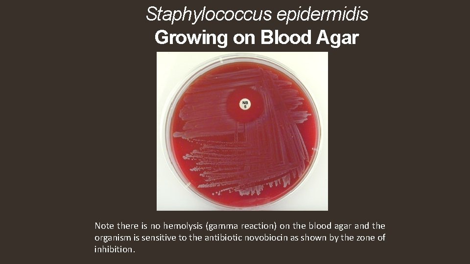 Staphylococcus epidermidis Growing on Blood Agar Note there is no hemolysis (gamma reaction) on