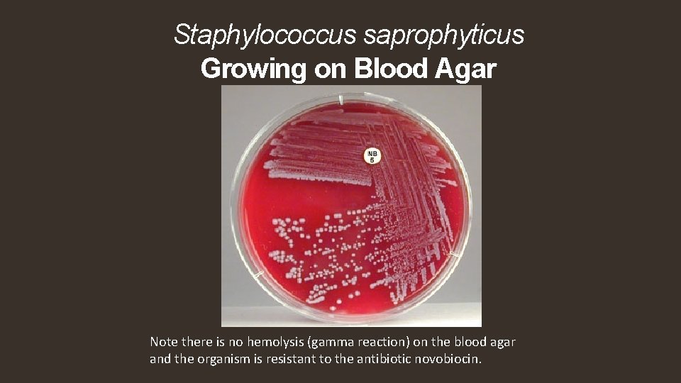 Staphylococcus saprophyticus Growing on Blood Agar Note there is no hemolysis (gamma reaction) on