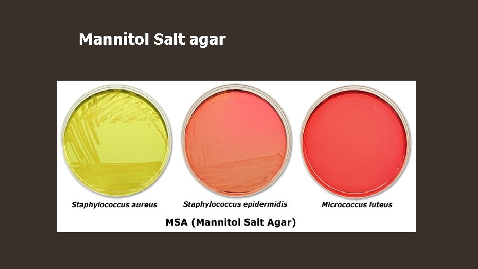 Mannitol Salt agar 