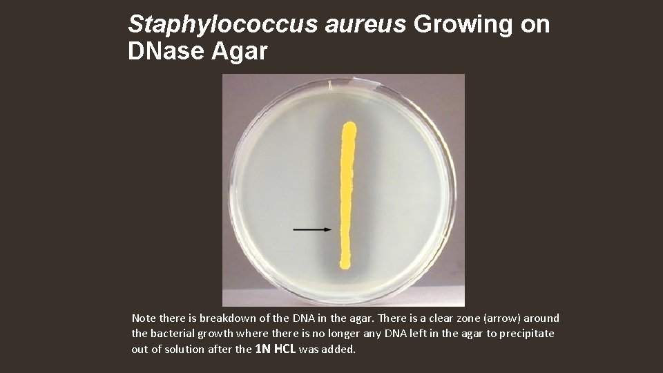 Staphylococcus aureus Growing on DNase Agar Note there is breakdown of the DNA in