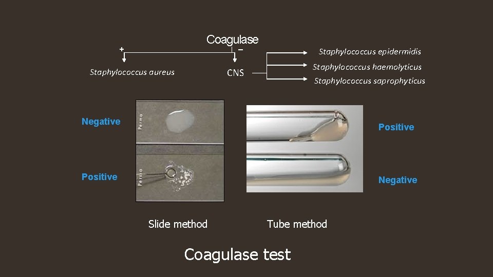 Coagulase _ + Staphylococcus epidermidis Staphylococcus haemolyticus CNS Staphylococcus aureus Staphylococcus saprophyticus Negative Positive