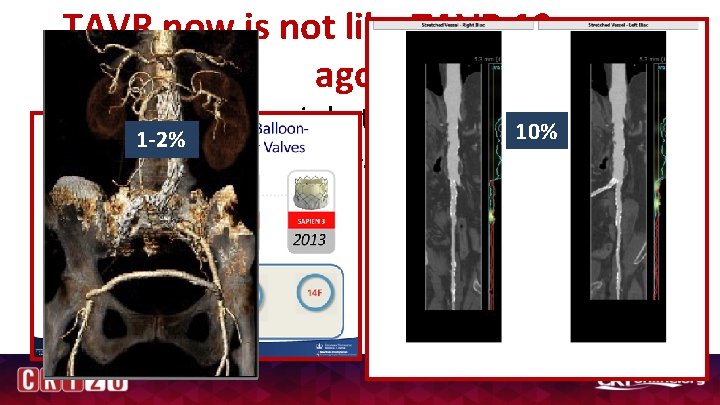 TAVR now is not like TAVR 10 years ago… • Valve technology is better