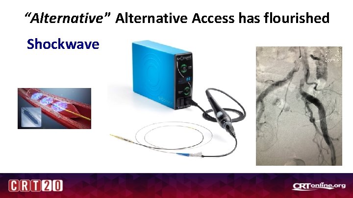 “Alternative” Alternative Access has flourished Shockwave 