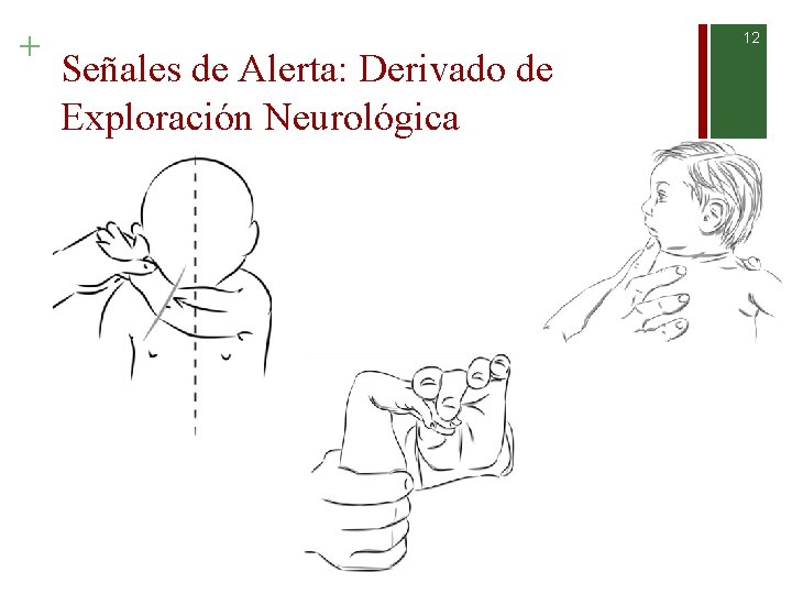 + 12 Señales de Alerta: Derivado de Exploración Neurológica 