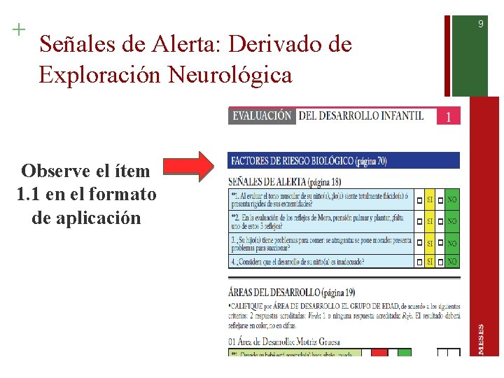 + 9 Señales de Alerta: Derivado de Exploración Neurológica Observe el ítem 1. 1