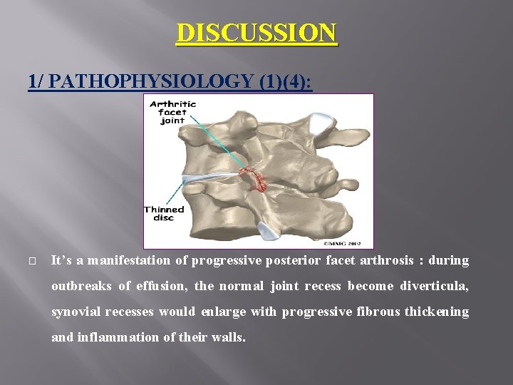 DISCUSSION 1/ PATHOPHYSIOLOGY (1)(4): � It’s a manifestation of progressive posterior facet arthrosis :