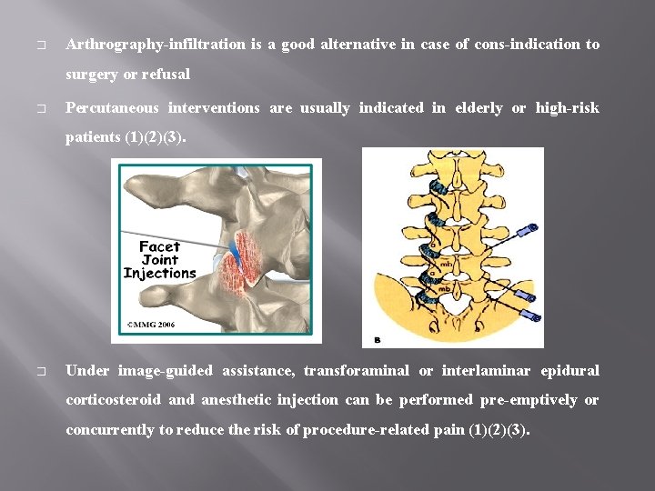 � Arthrography-infiltration is a good alternative in case of cons-indication to surgery or refusal