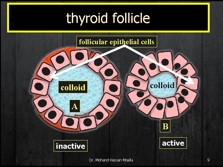 thyroid follicle follicular epithelial cells colloid A B active inactive Dr. Mohand Hassan Moalla