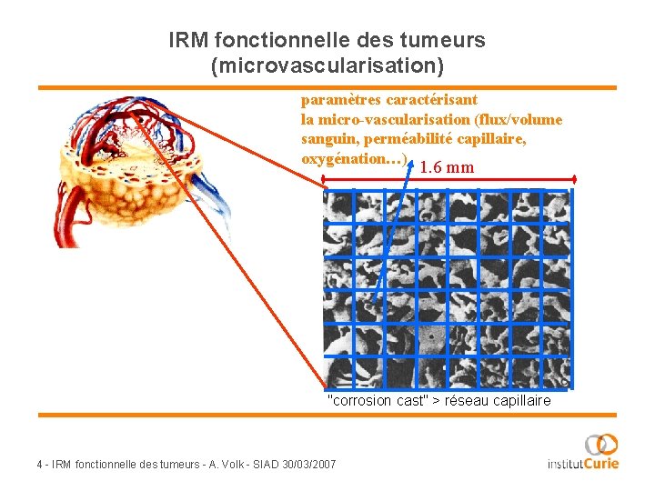 IRM fonctionnelle des tumeurs (microvascularisation) paramètres caractérisant la micro-vascularisation (flux/volume sanguin, perméabilité capillaire, oxygénation…)