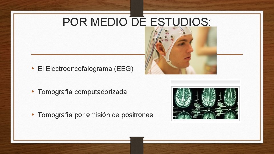 POR MEDIO DE ESTUDIOS: • El Electroencefalograma (EEG) • Tomografía computadorizada • Tomografía por