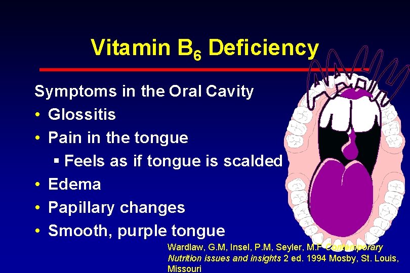 Vitamin B 6 Deficiency Symptoms in the Oral Cavity • Glossitis • Pain in