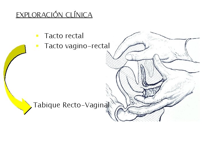 EXPLORACIÓN CLÍNICA § Tacto rectal § Tacto vagino-rectal Tabique Recto-Vaginal 