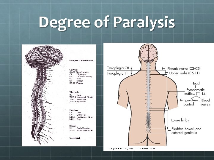 Degree of Paralysis 