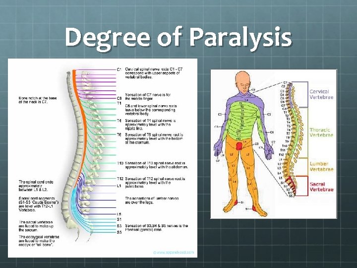 Degree of Paralysis 